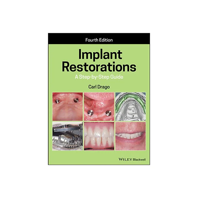 Implant Restorations: A Step-by-Step Guide