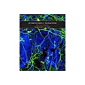 Intervention And Reflection Basic Issues In Bioethics 10Th Edition