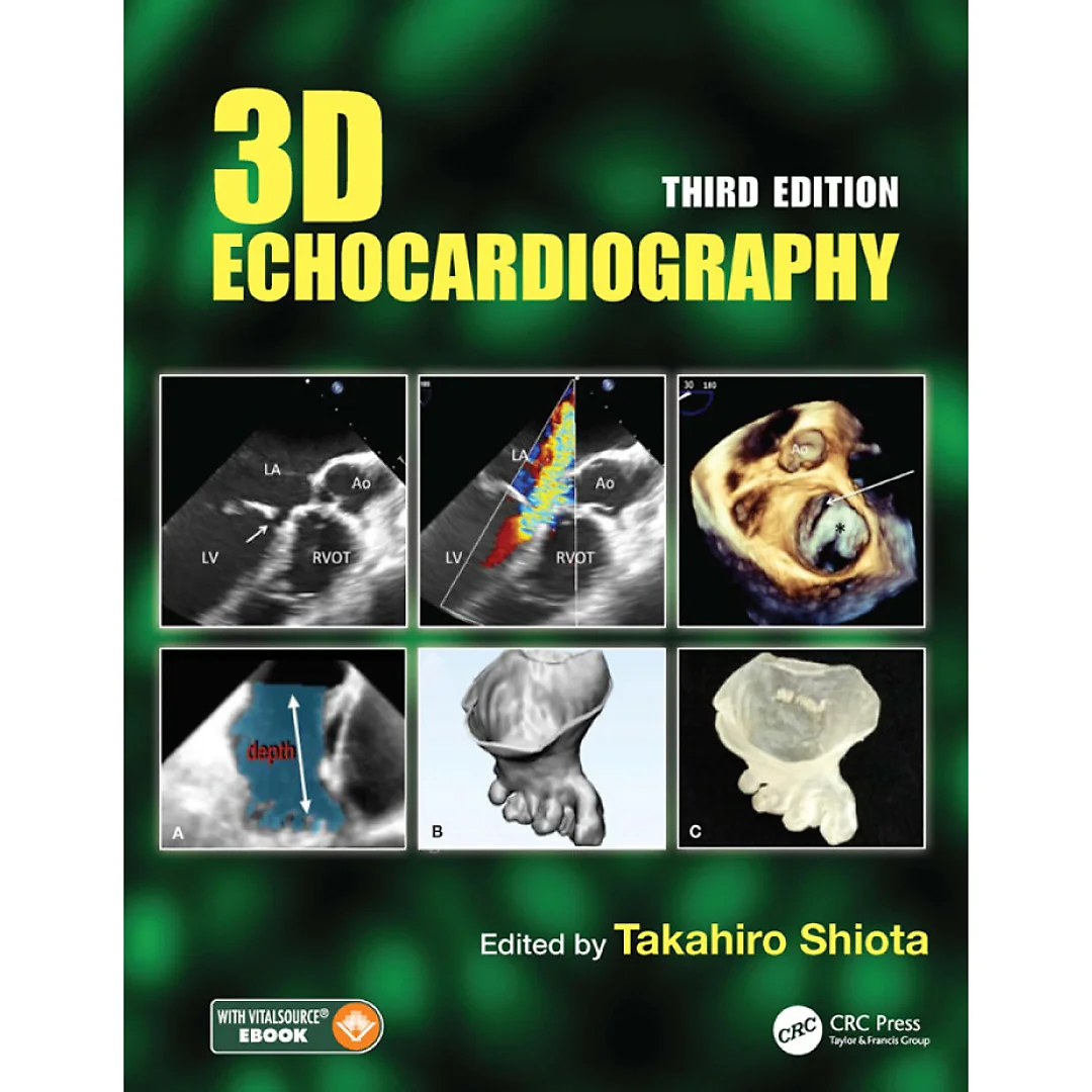 3D Echocardiography
