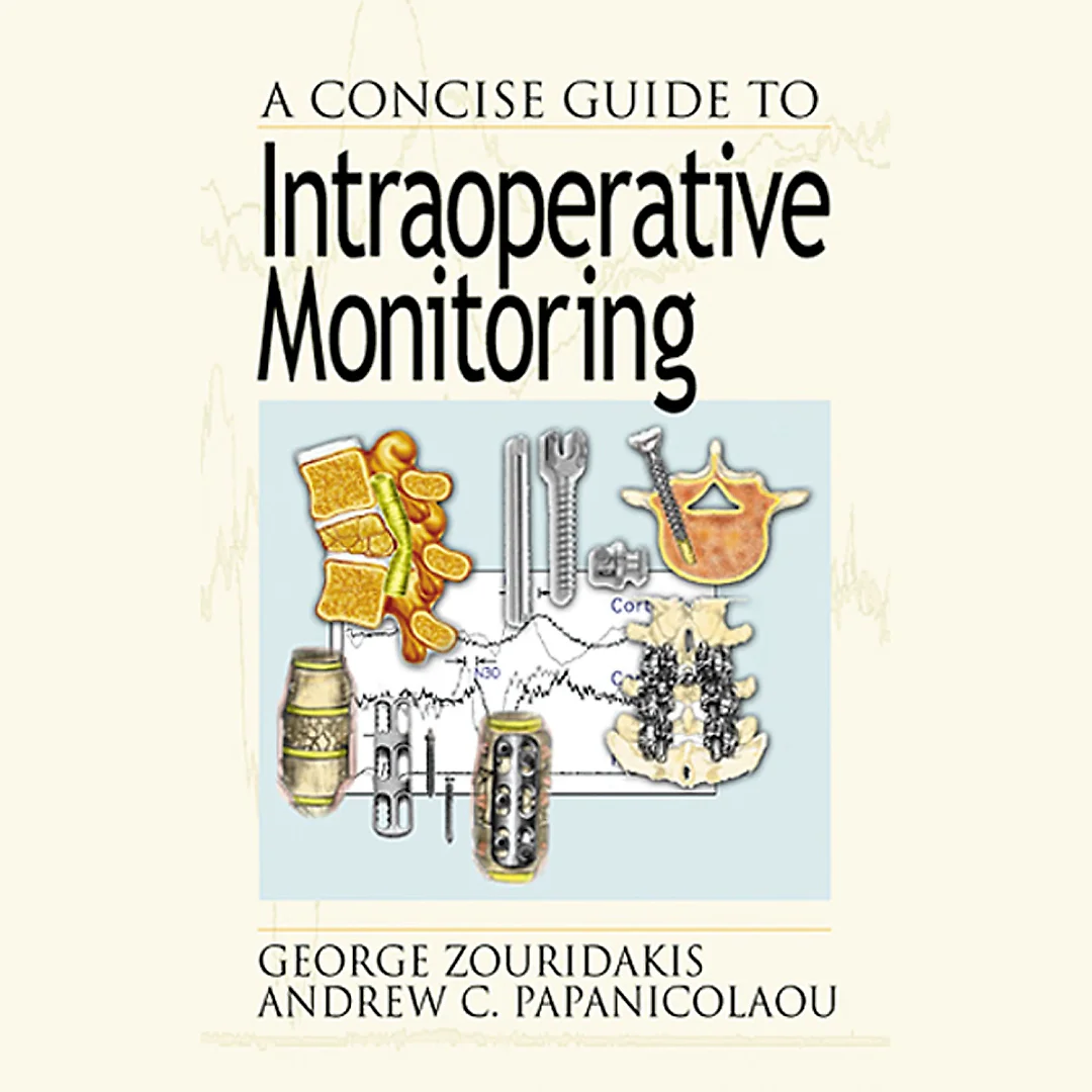 A Concise Guide to Intraoperative Monitoring