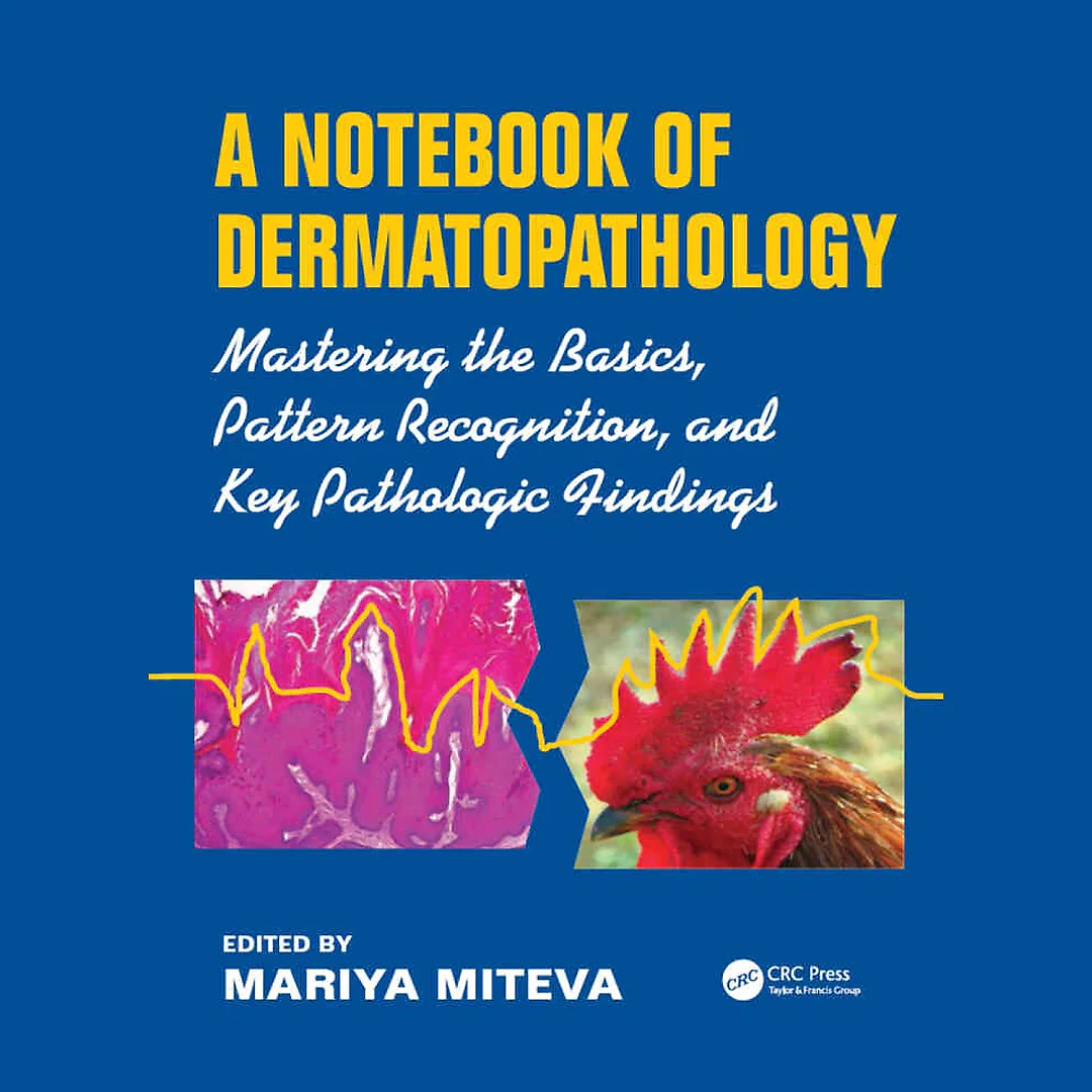 A Notebook of Dermatopathology: Mastering the Basics, Pattern Recognition, and Key Pathologic Findings