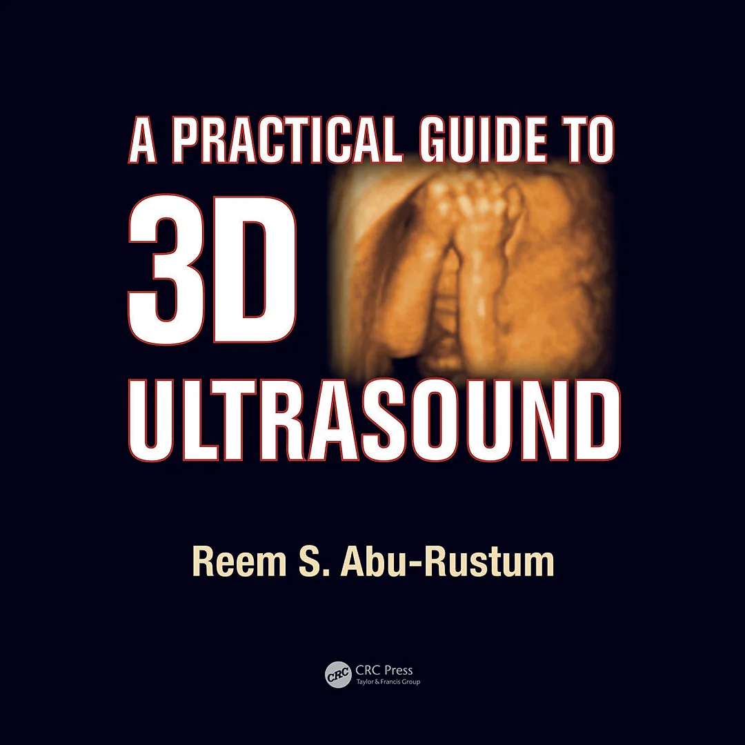 A Practical Guide to 3D Ultrasound