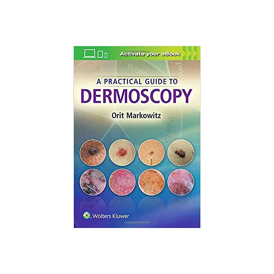 A Practical Guide to Dermoscopy