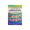 A Practical Guide to Dermoscopy