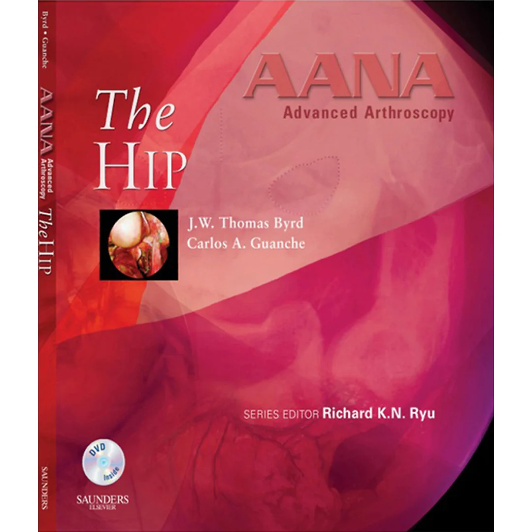 AANA Advanced Arthroscopy: The Hip