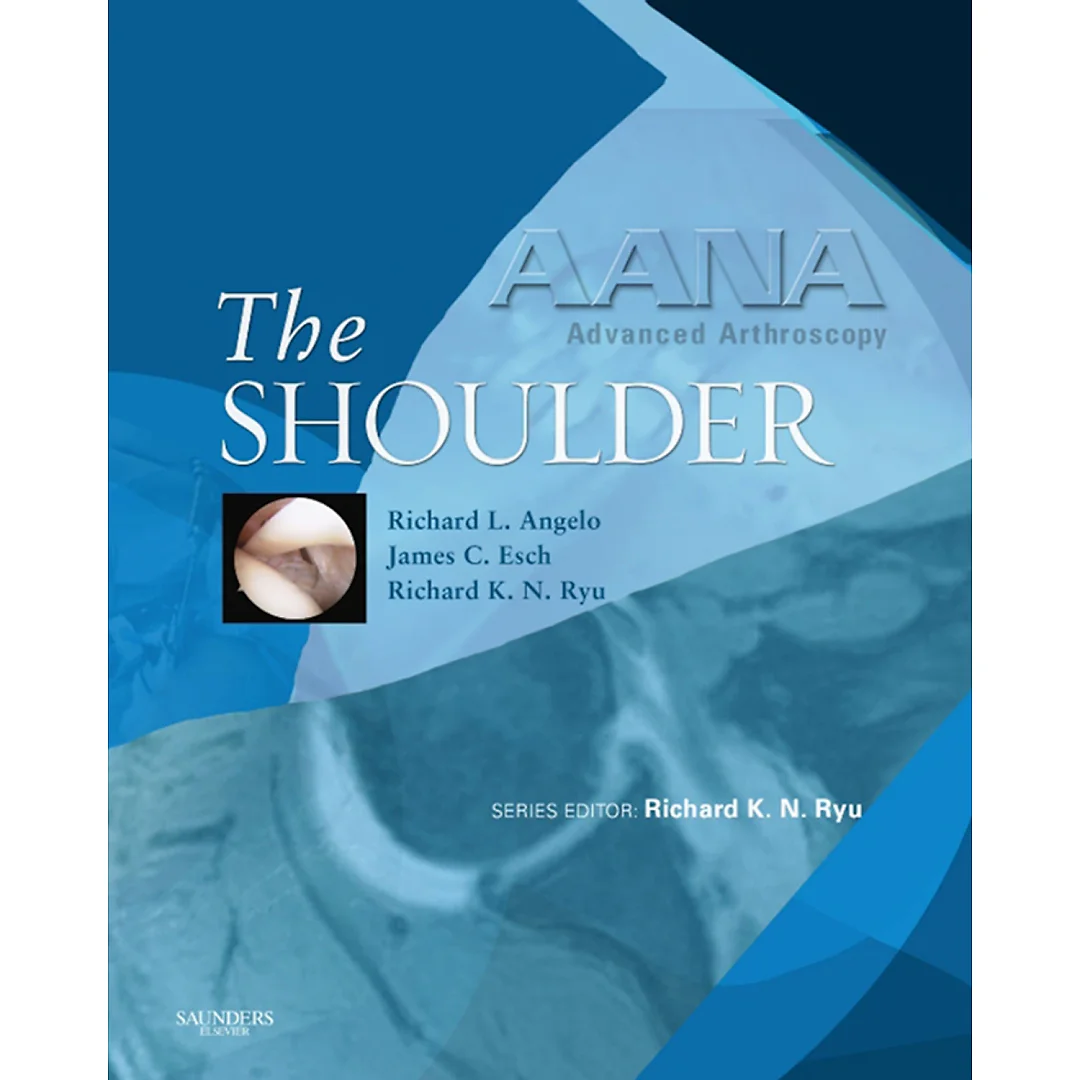 AANA Advanced Arthroscopy: The Shoulder - Electronic