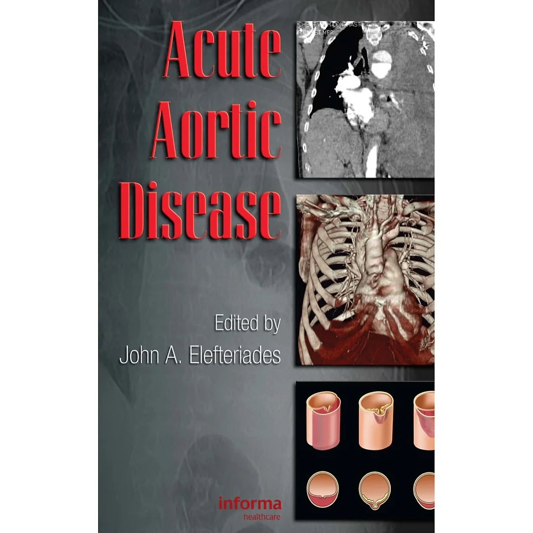 Acute Aortic Disease