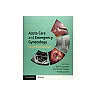 Acute Care and Emergency Gynecology: A Case-Based Approach