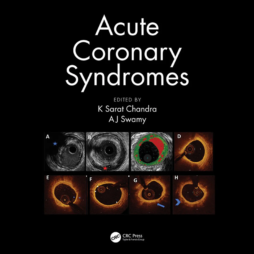 Acute Coronary Syndromes