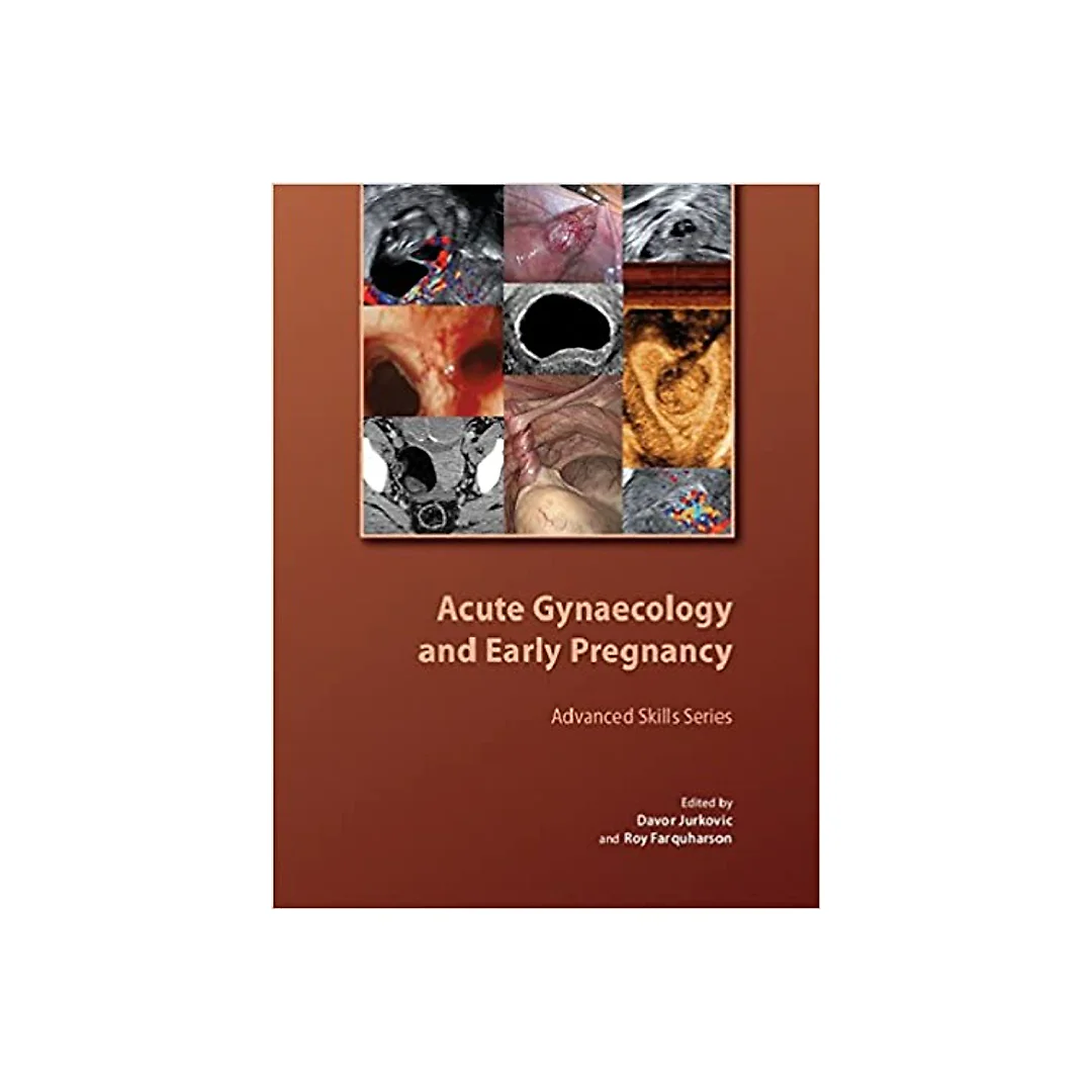 Acute Gynaecology and Early Pregnancy