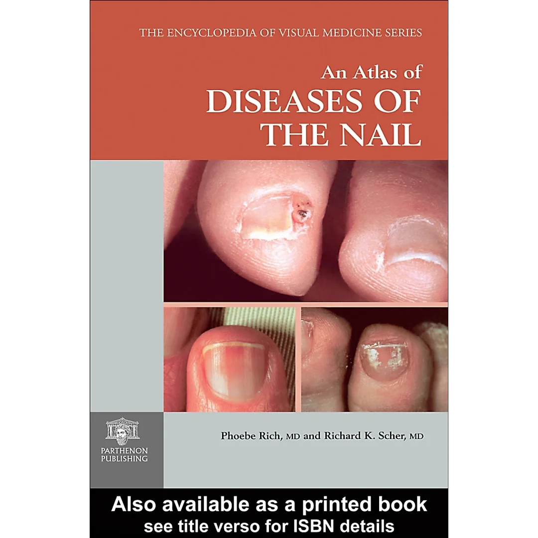 An Atlas of Diseases of the Nail