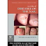 An Atlas of Diseases of the Nail