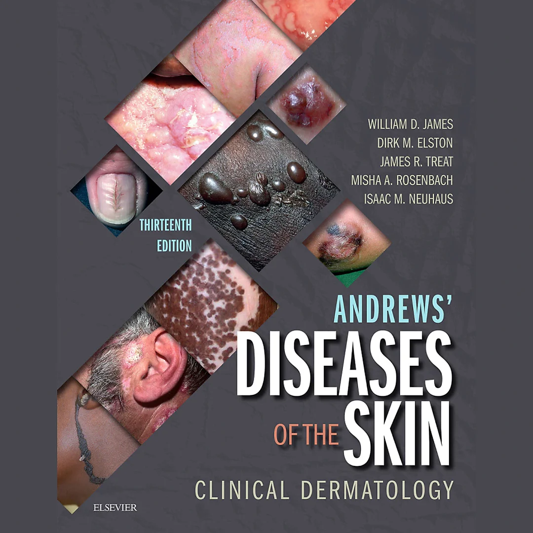 Andrews' Diseases of the Skin Clinical Dermatology