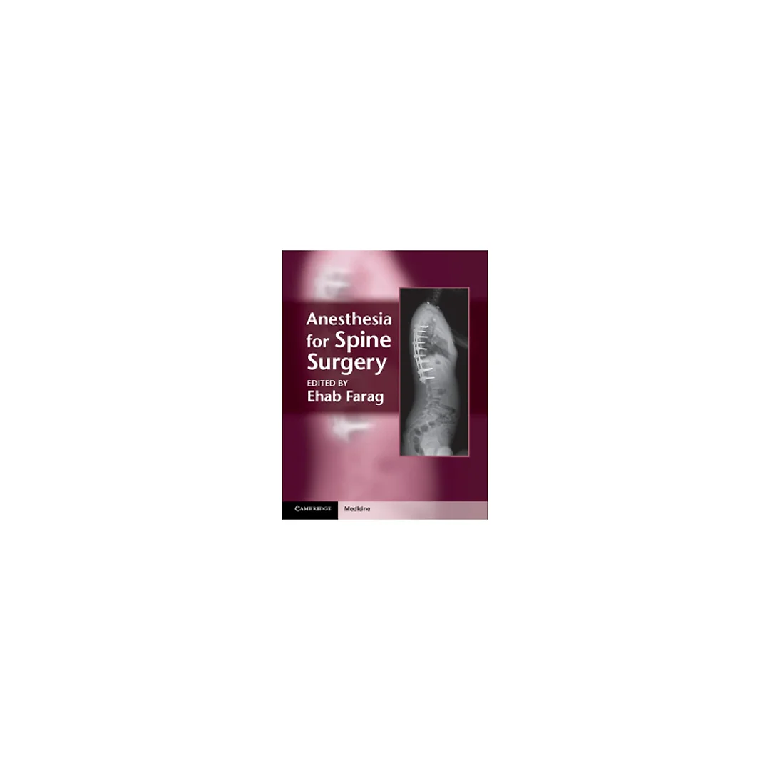 Anesthesia for Spine Surgery