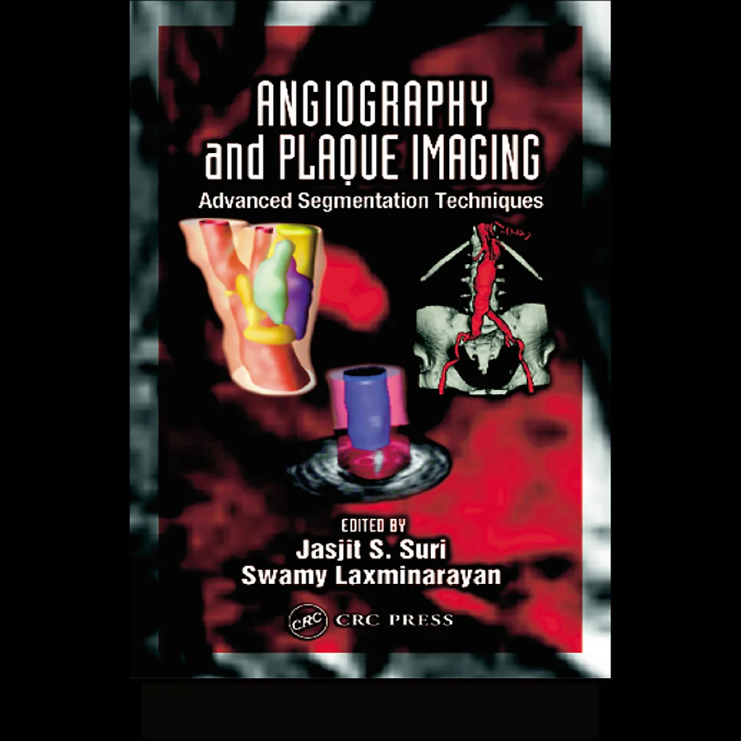 Angiography and Plaque Imaging: Advanced Segmentation Techniques