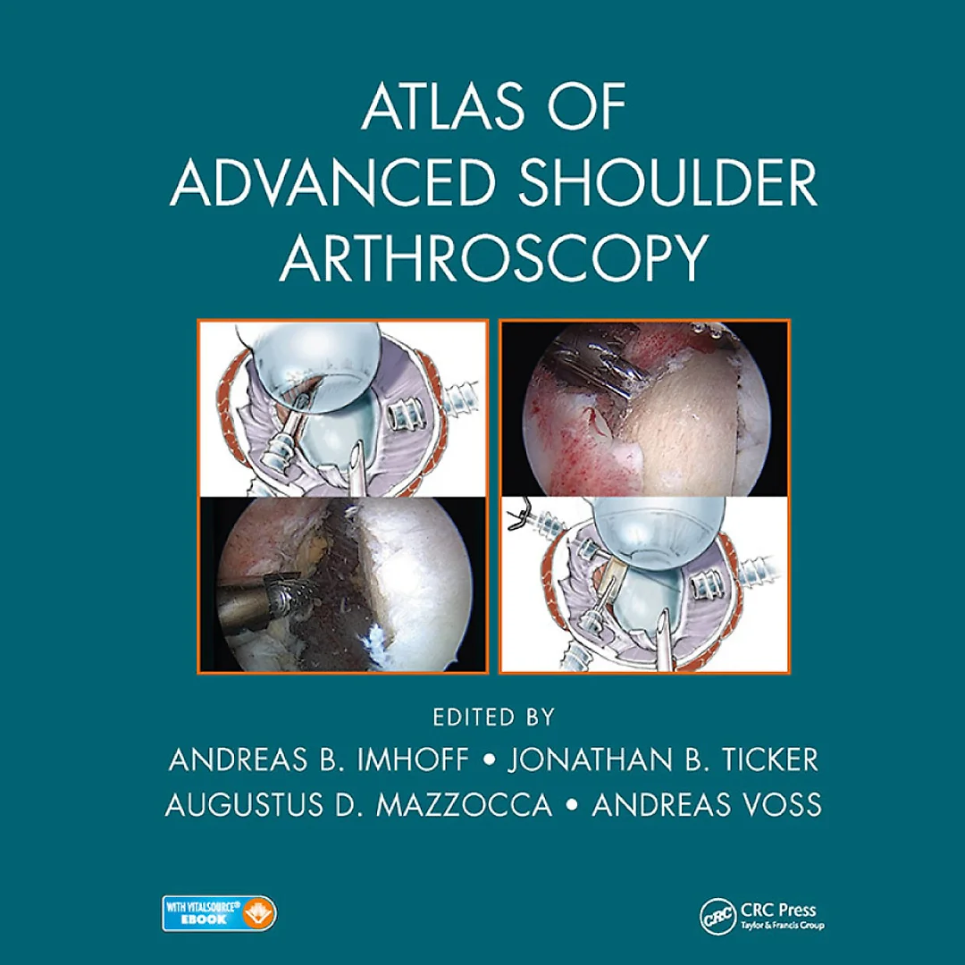 Atlas of Advanced Shoulder Arthroscopy