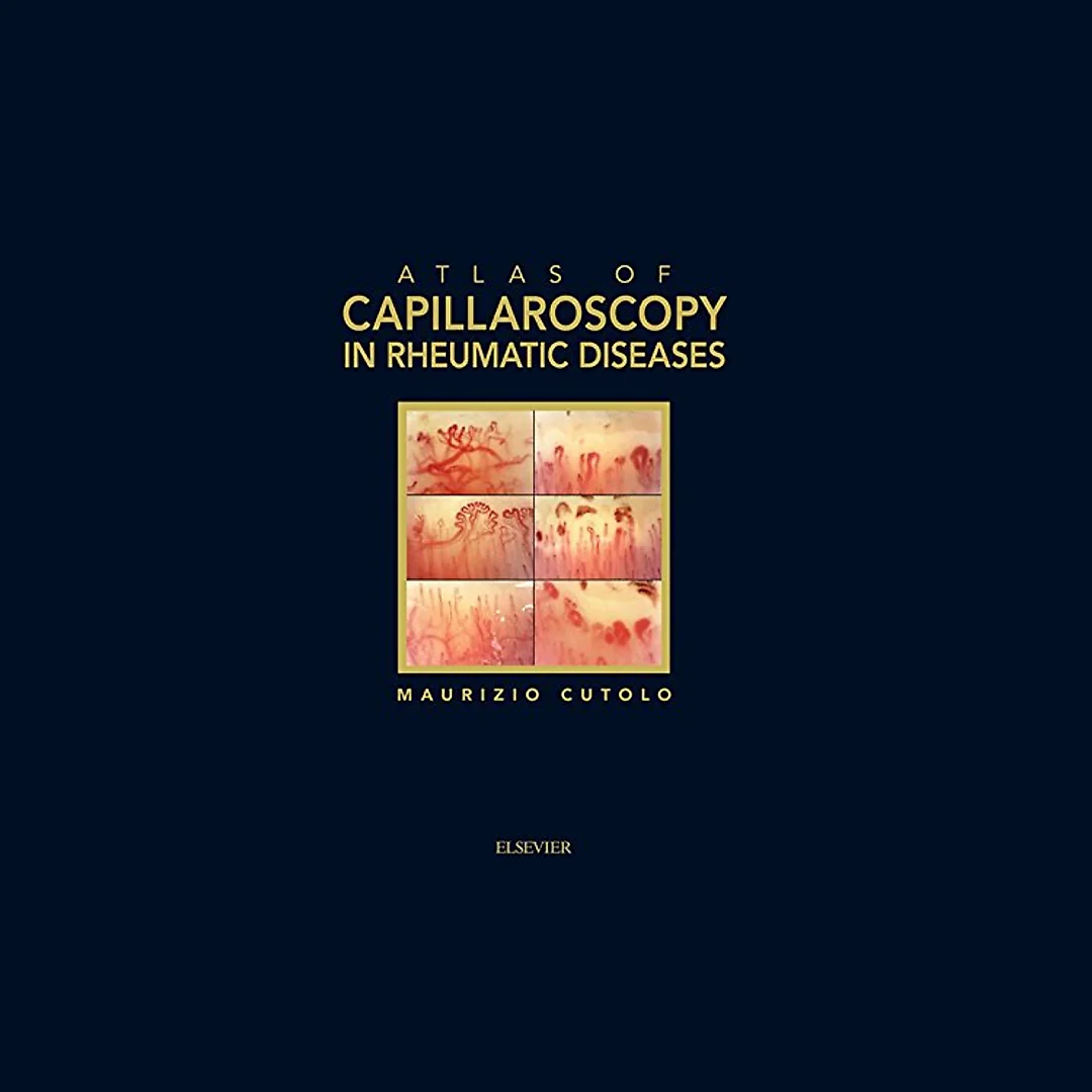 Atlas of capillaroscopy in rheumatic diseases