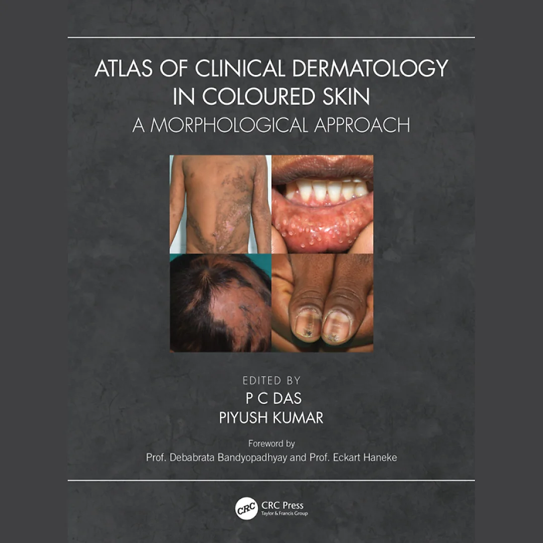 Atlas of Clinical Dermatology in Coloured Skin: A Morphological Approach
