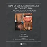 Atlas of Clinical Dermatology in Coloured Skin: A Morphological Approach