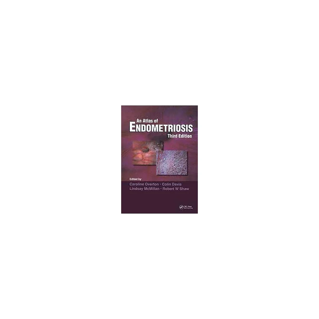 Atlas of Endometriosis