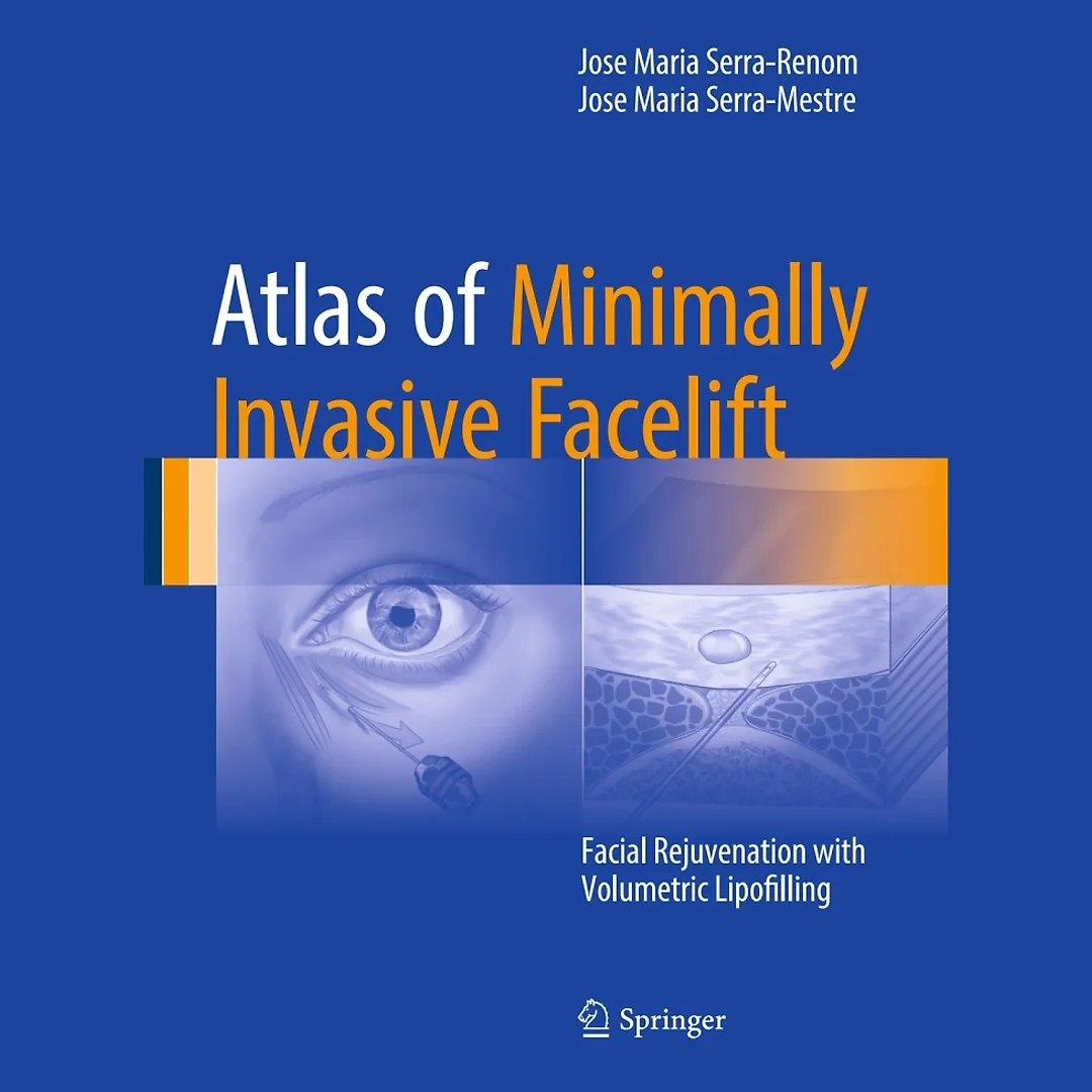 Atlas of Minimally Invasive Facelift: Facial Rejuvenation with Volumetric Lipofilling
