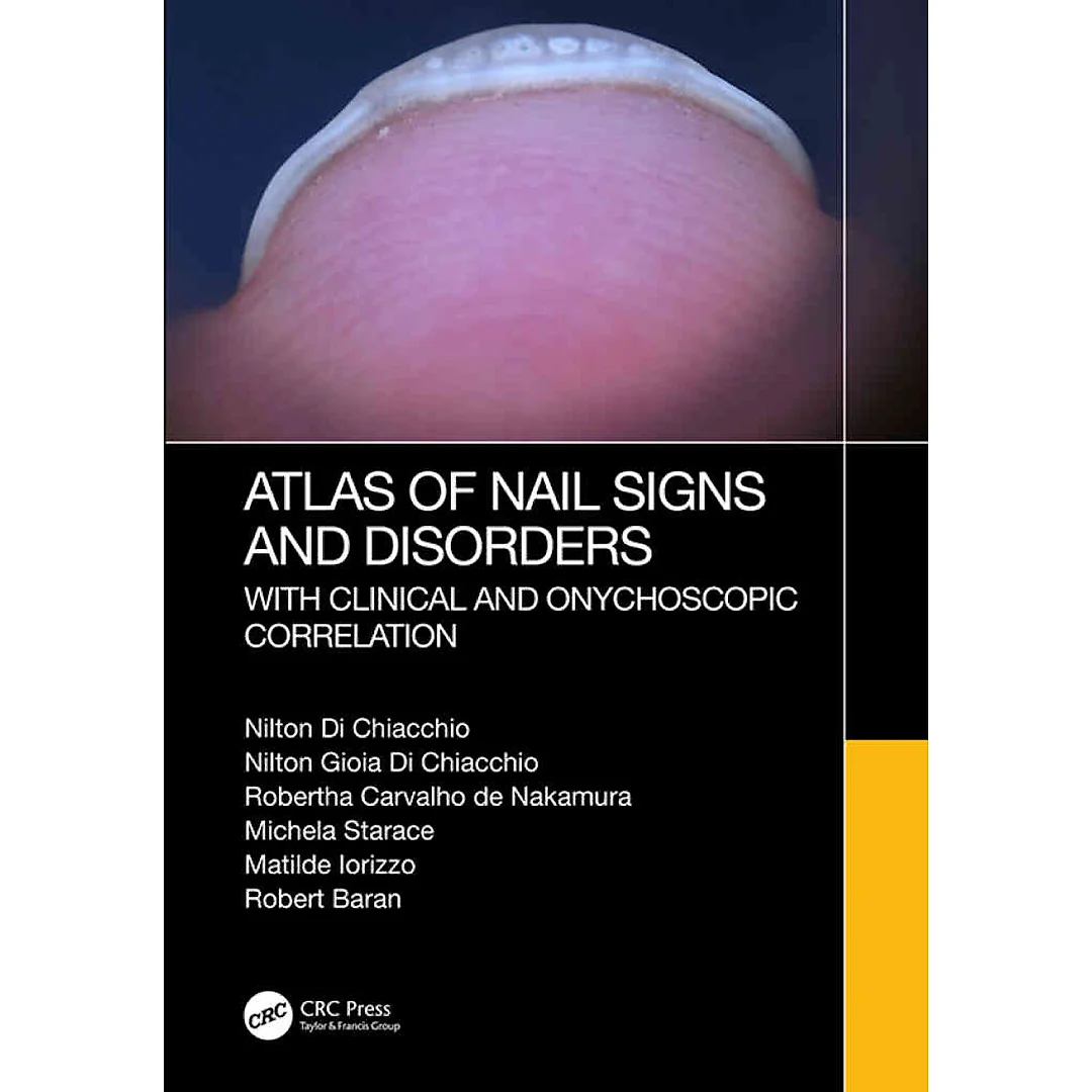 Atlas of Nail Signs and Disorders with Clinical and Onychoscopic Correlation