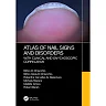 Atlas of Nail Signs and Disorders with Clinical and Onychoscopic Correlation