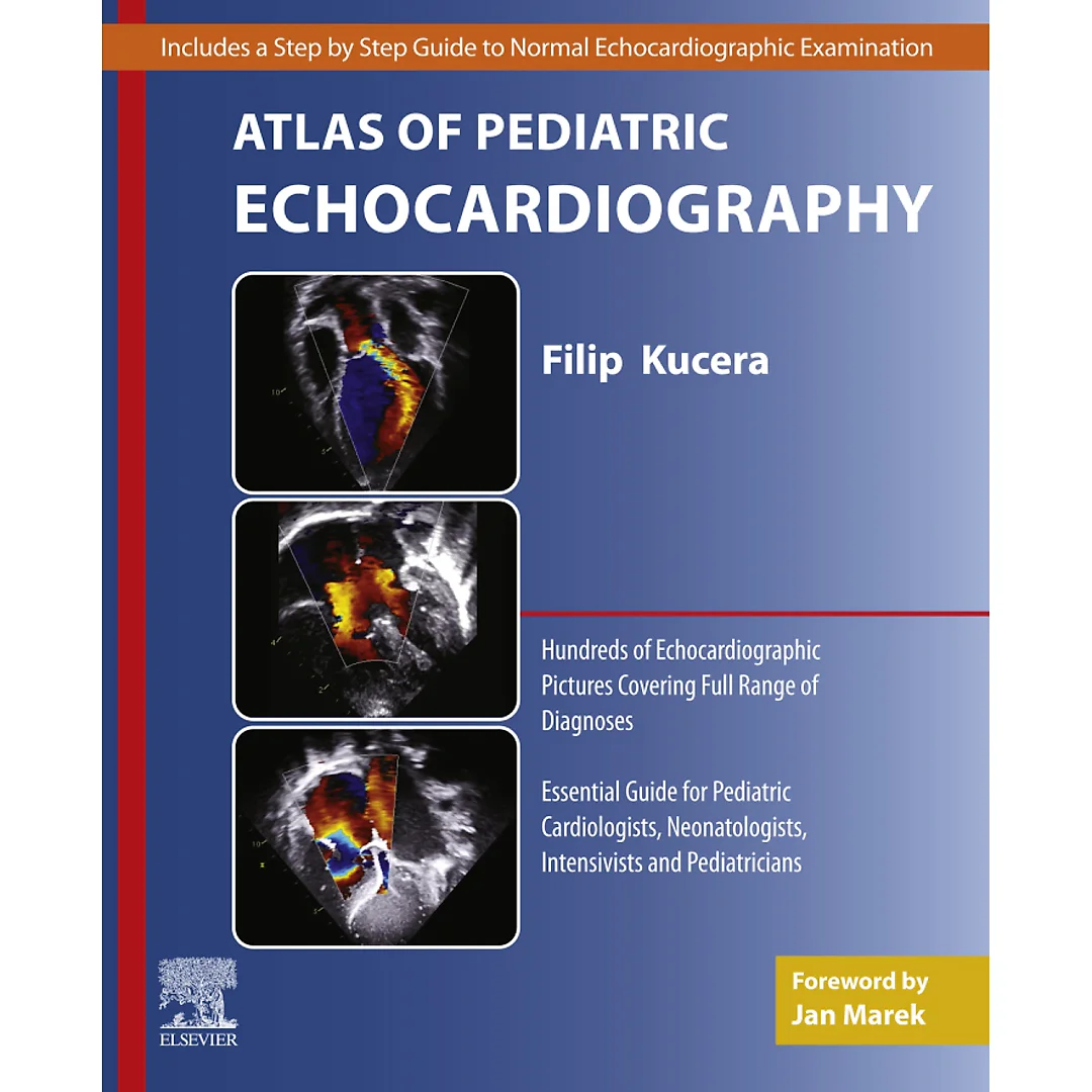 Atlas of Pediatric Echocardiography