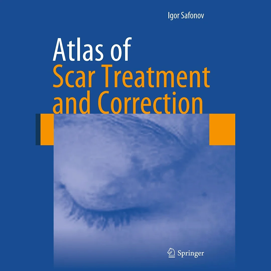 Atlas of Scar Treatment and Correction