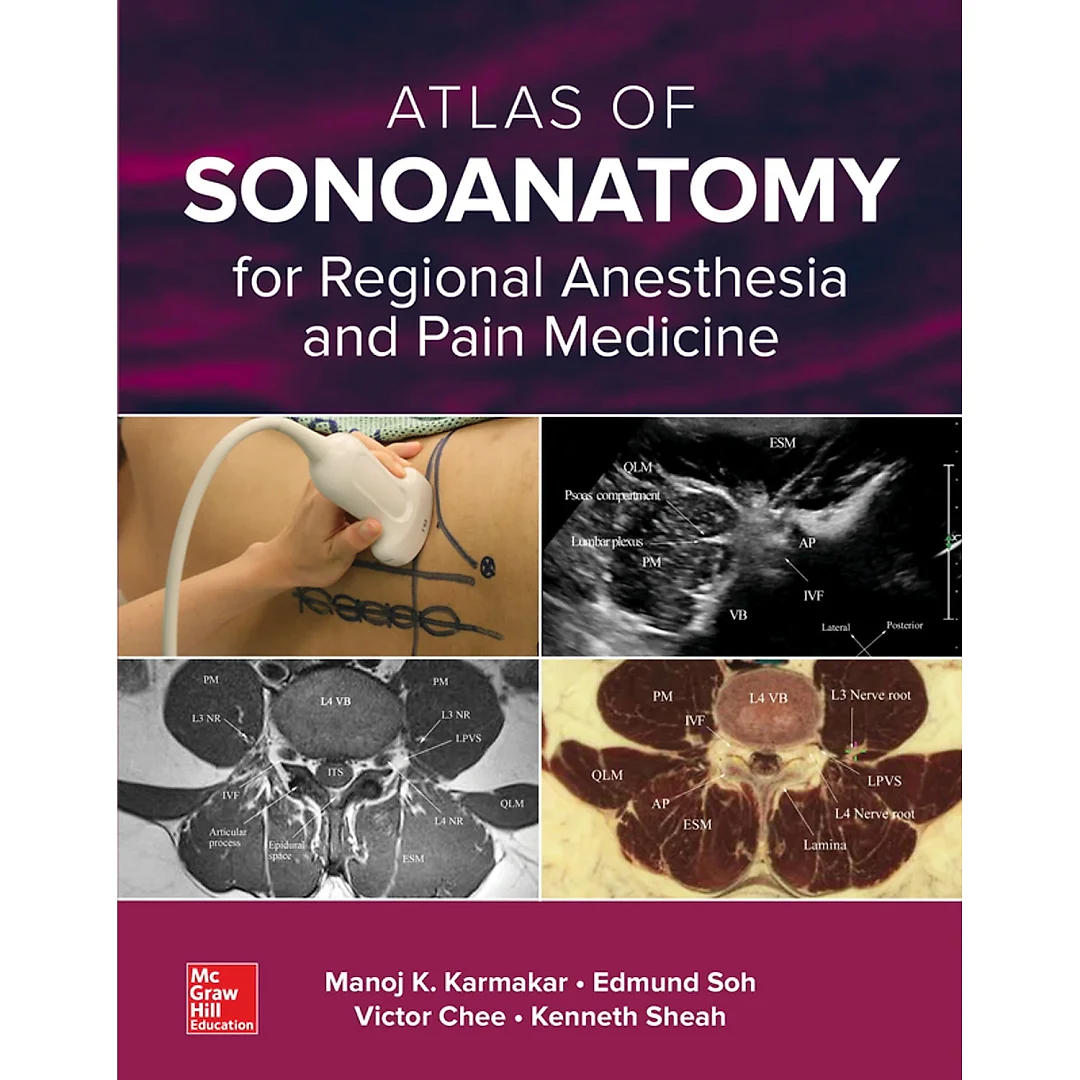 Atlas of Sonoanatomy for Regional Anesthesia and Pain Medicine