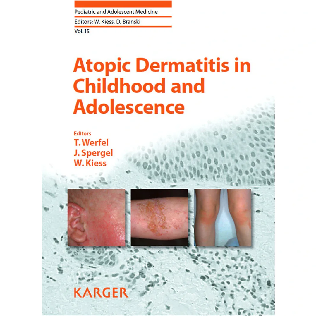 Atopic Dermatitis in Childhood and Adolescence