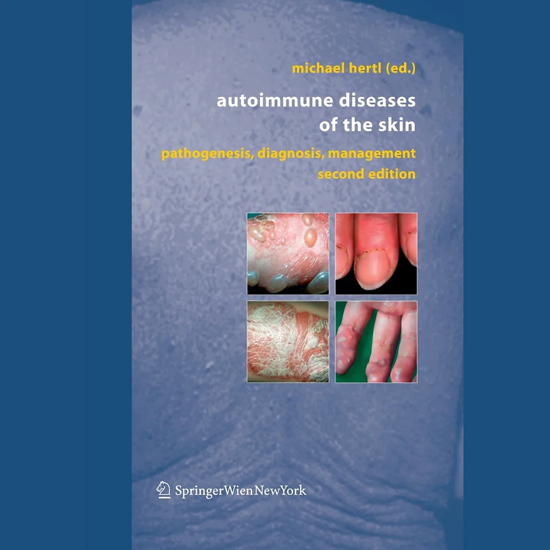 Autoimmune Diseases of the Skin: Pathogenesis Diagnosis Management