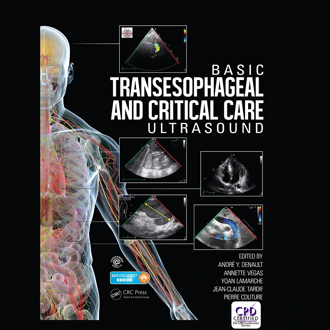 Basic Transesophageal and Critical Care Ultrasound