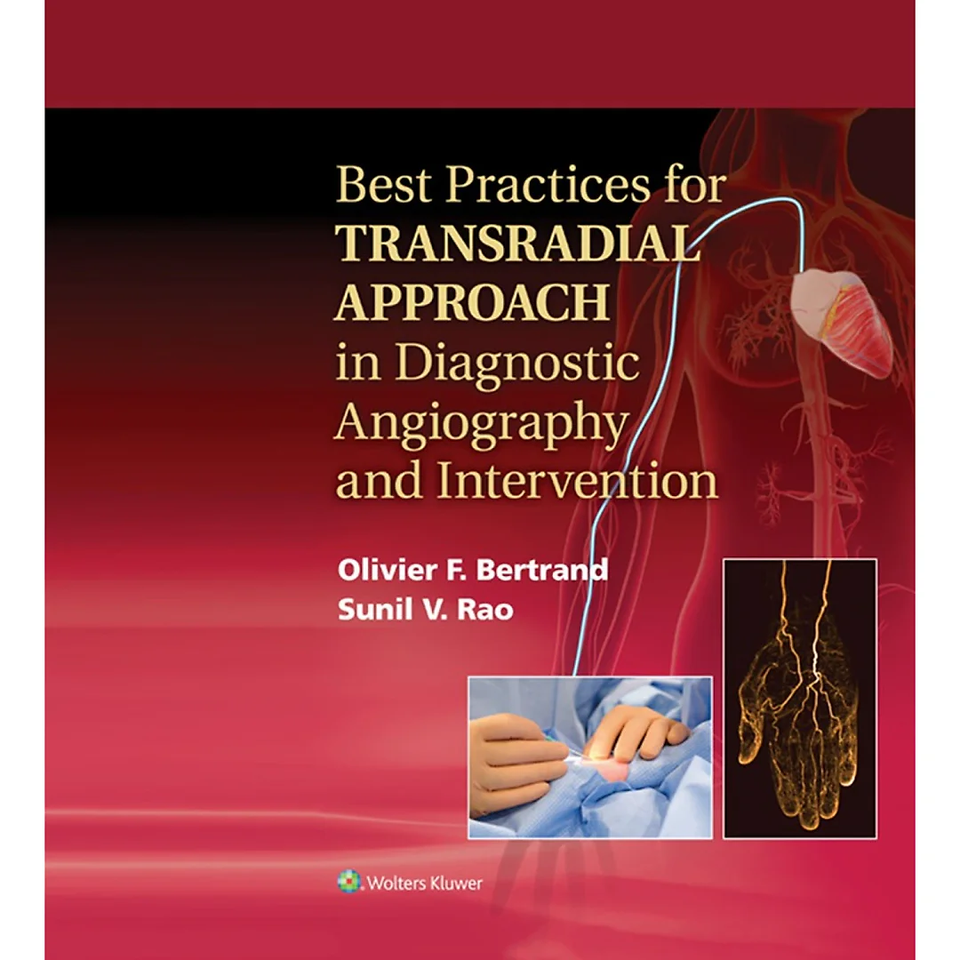 Best Practices for Transradial Approach in Diagnostic Angiography and Intervention