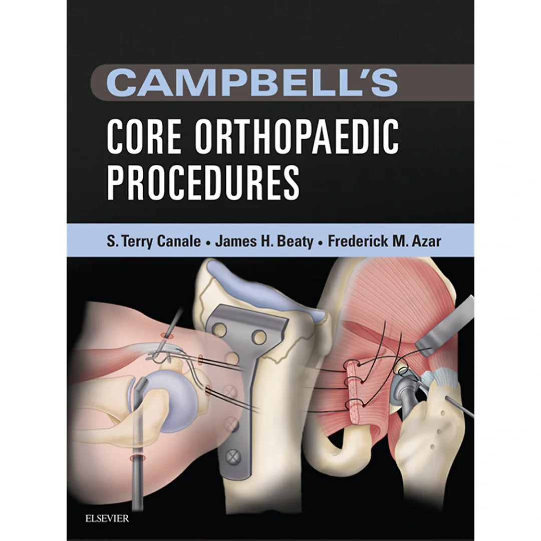Campbell's Core Orthopaedic Procedures