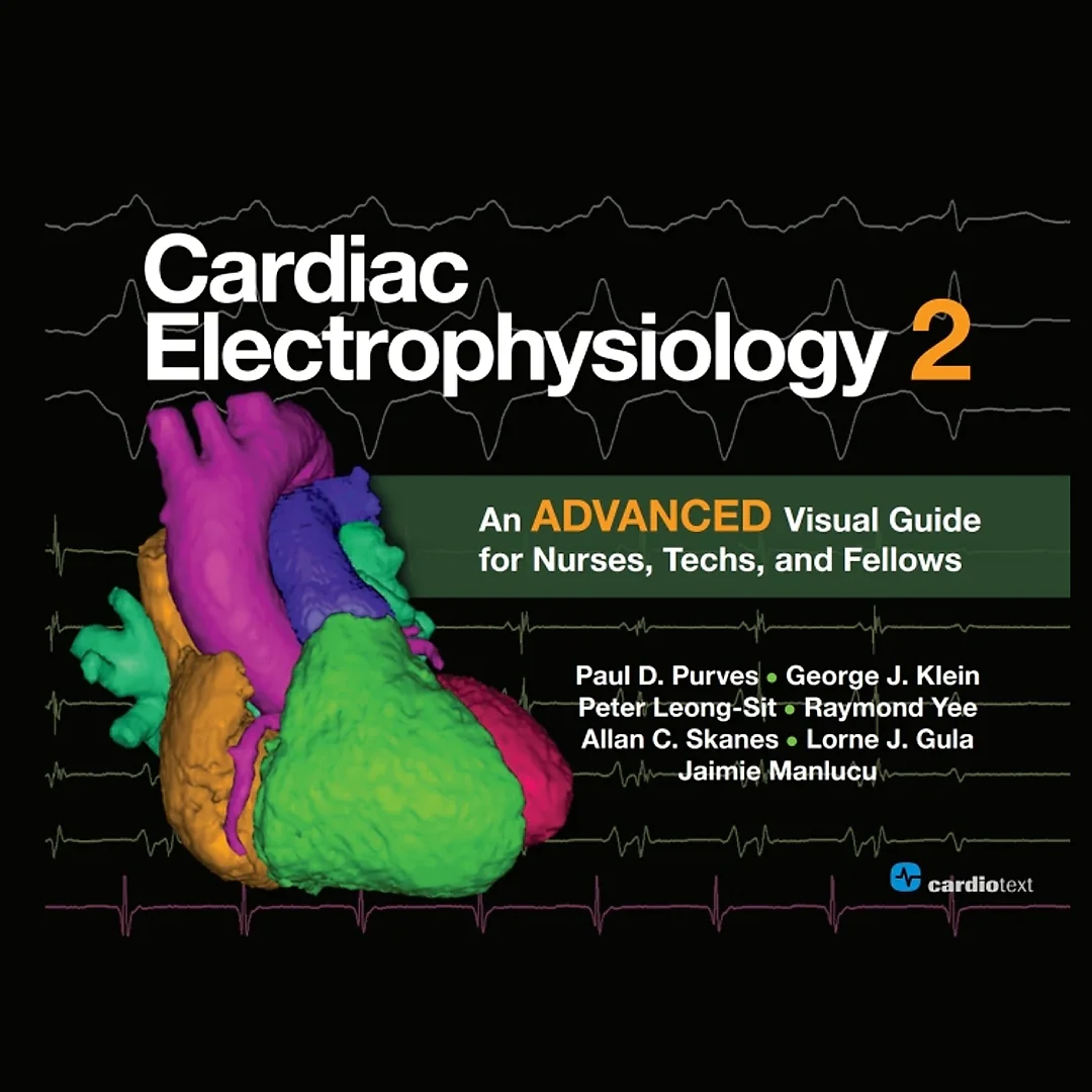 Cardiac Electrophysiology 2: An Advanced Visual Guide for Nurses, Techs, and Fellows