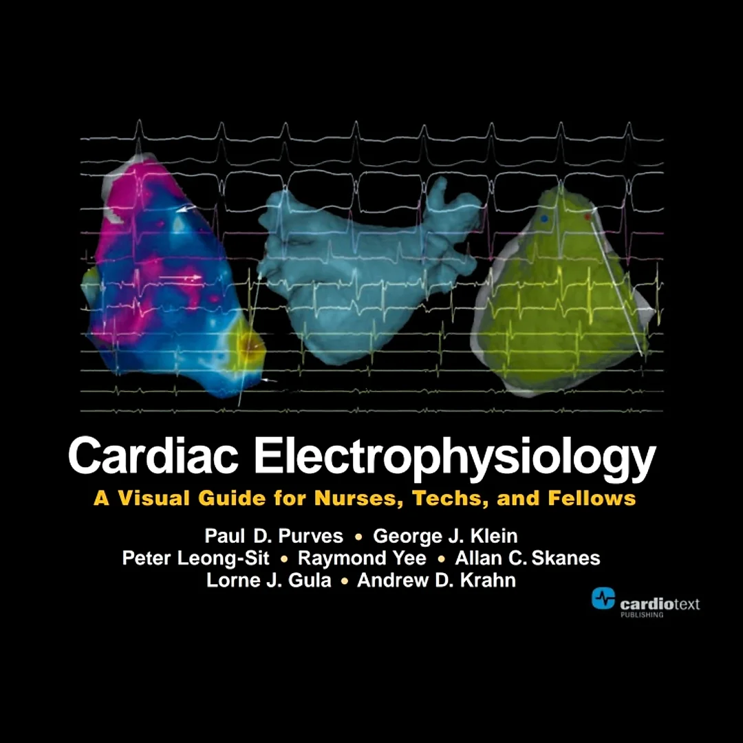 Cardiac Electrophysiology: A Visual Guide for Nurses, Techs, and Fellows