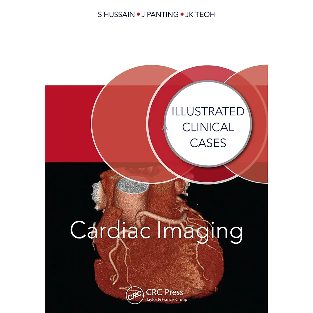 Cardiac Imaging: Illustrated Clinical Cases