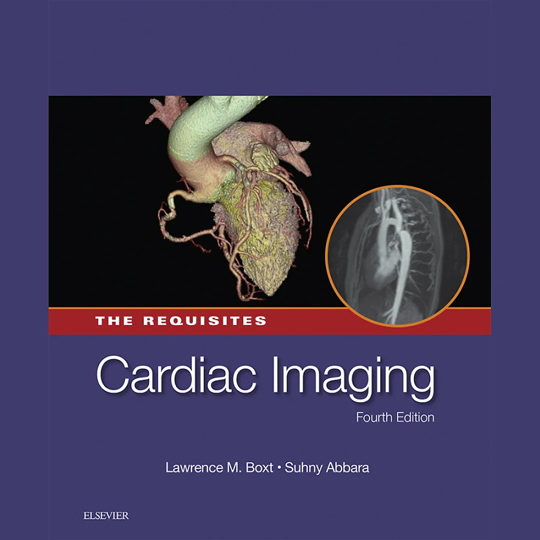 Cardiac Imaging: The Requisites E-Book