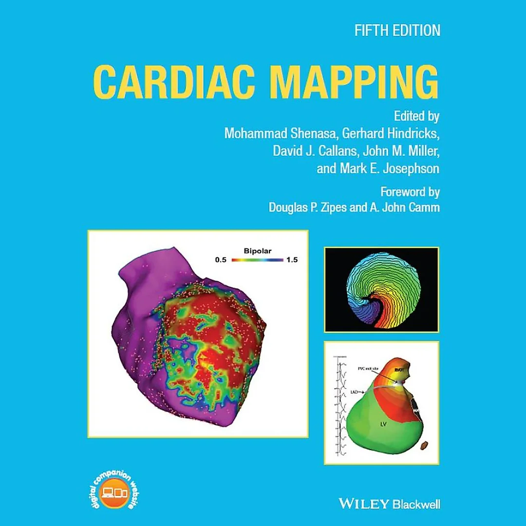 Cardiac Mapping