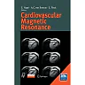 Cardiovascular Magnetic Resonance
