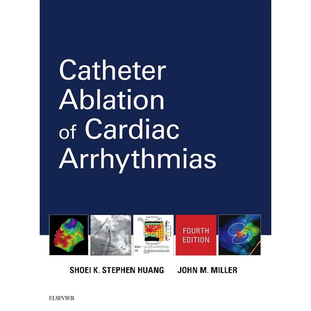 Catheter Ablation of Cardiac Arrhythmias