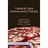 Cerebral Dural Arteriovenous Fistulas