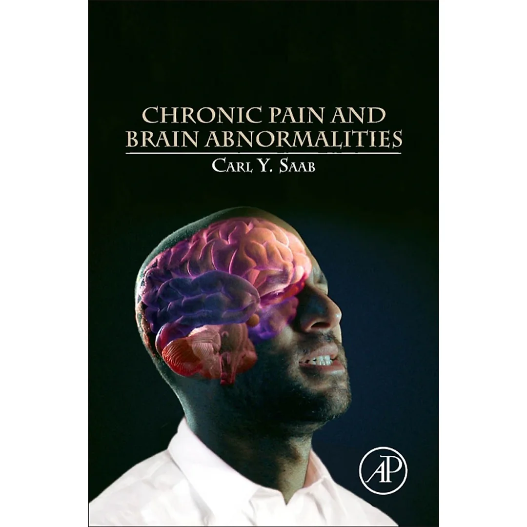 Chronic Pain and Brain Abnormalities