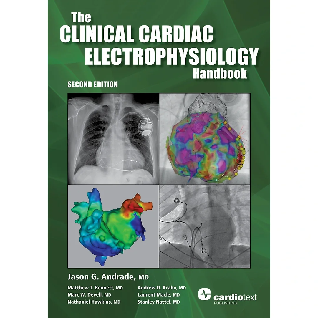 Clinical Cardiac Electrophysiology Handbook, Second Edition