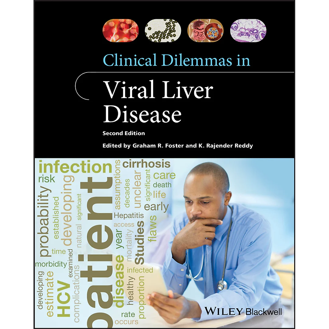 Clinical Dilemmas in Viral Liver Disease