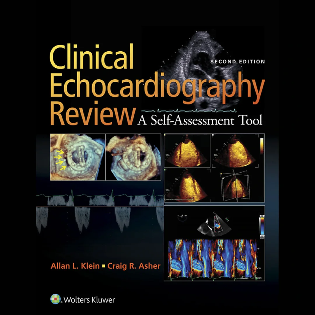 Clinical Echocardiography Review