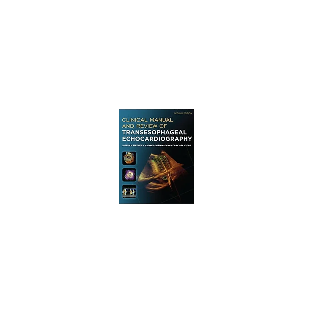 Clinical Manual and Review of Transesophageal Echocardiography, Second Edition eBook