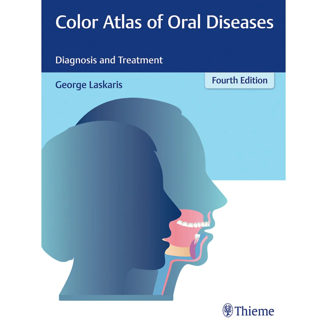 Color Atlas of Oral Diseases: Diagnosis and Treatment