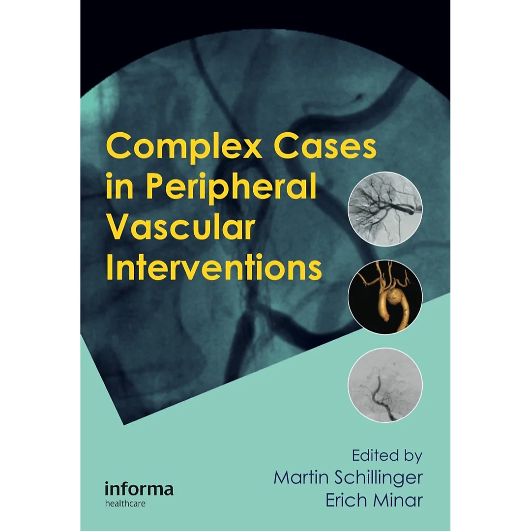 Complex Cases in Peripheral Vascular Interventions